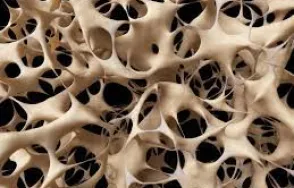 Diagnostika a léčba osteoporózy (1)